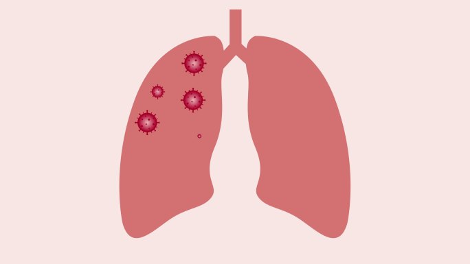 肺部的病毒和PM2.5动画