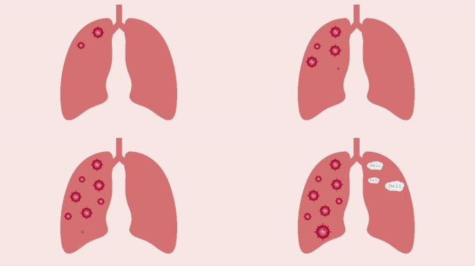 肺部的病毒和PM2.5动画