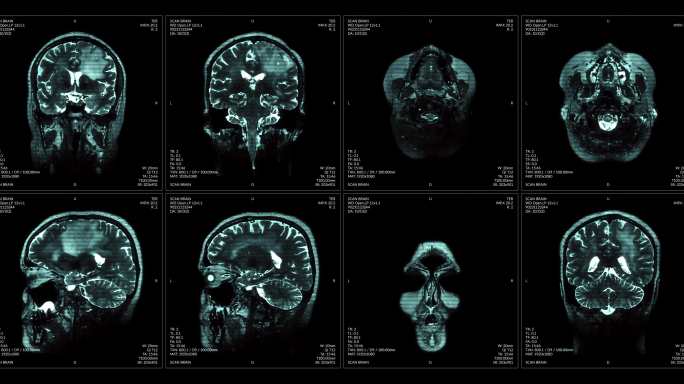 核磁共振成像视频墙。