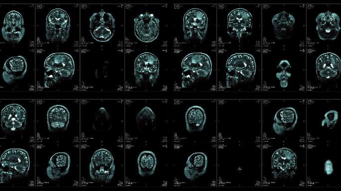 核磁共振成像视频墙。