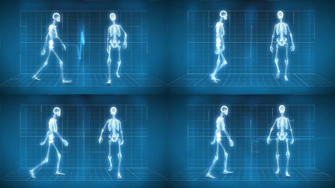 X射线骨骼走路视频素材三维立体