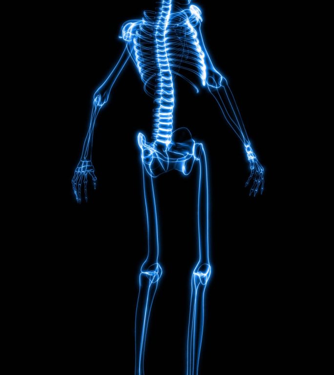 人体骨骼X射线