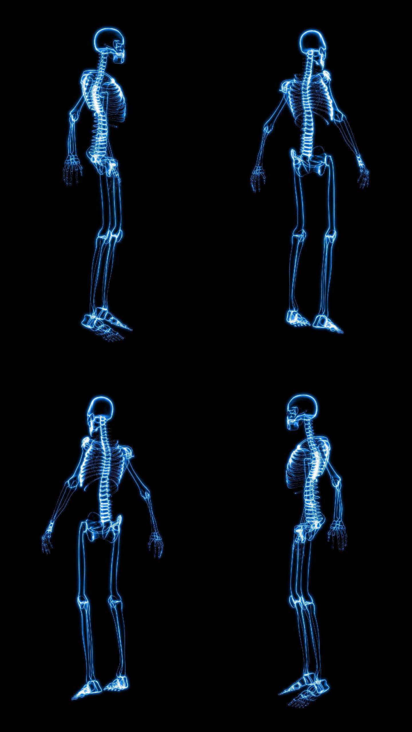 人体骨骼X射线