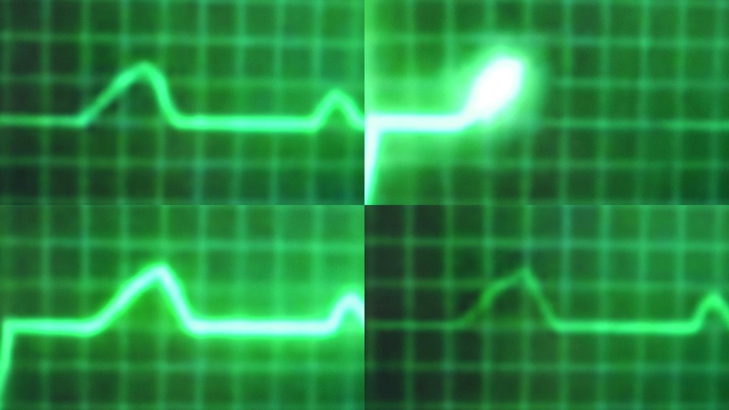 心电图心脏监护仪特效视频