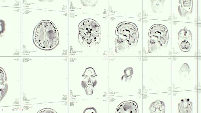 核磁共振视频墙科技医疗