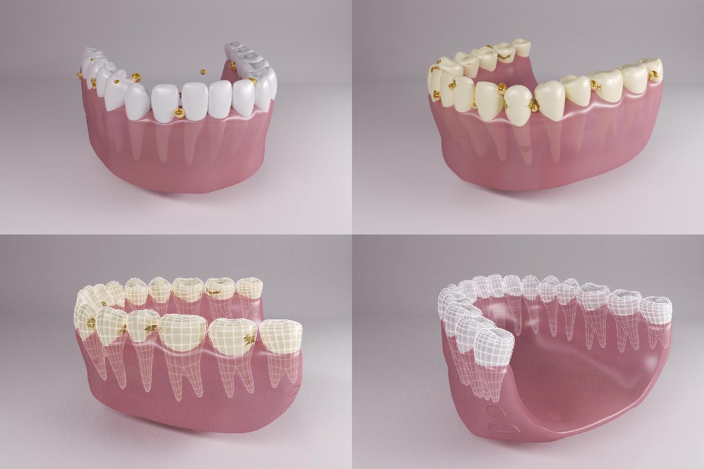 牙齿美白清洁细菌3d动画视频2