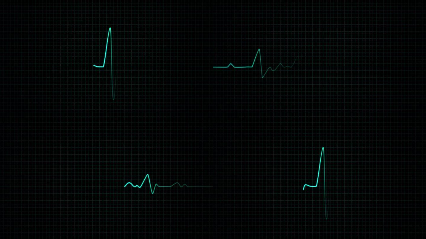 原创科技心电图AE模板