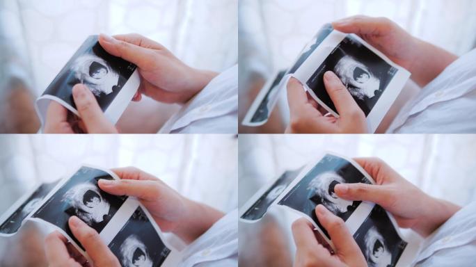 在看三维超声婴儿图像的孕妇