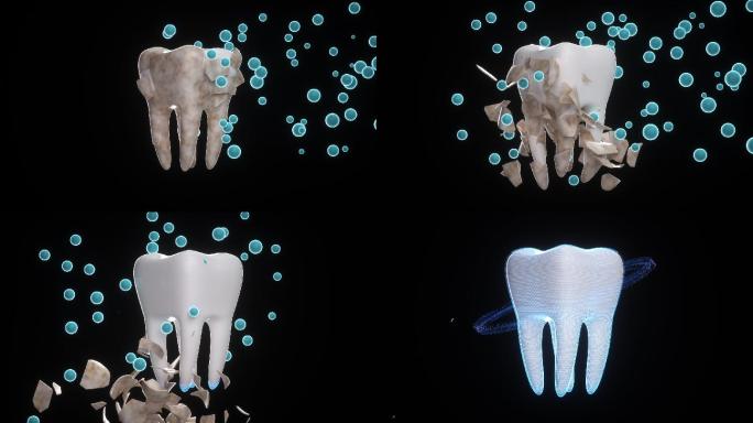 保护牙齿3D医疗演示破碎烂牙 牙垢