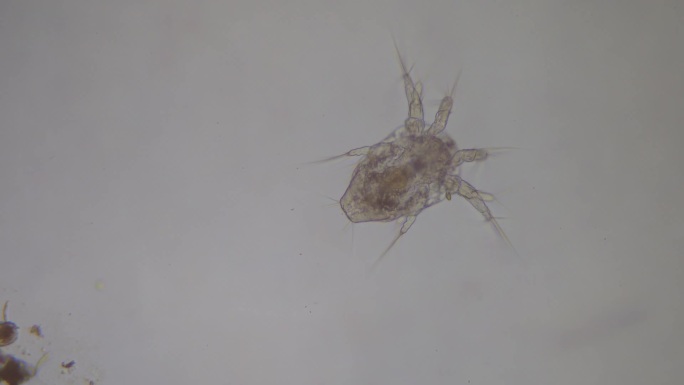 显微镜里的螨虫微生物节肢动物放大观看细菌