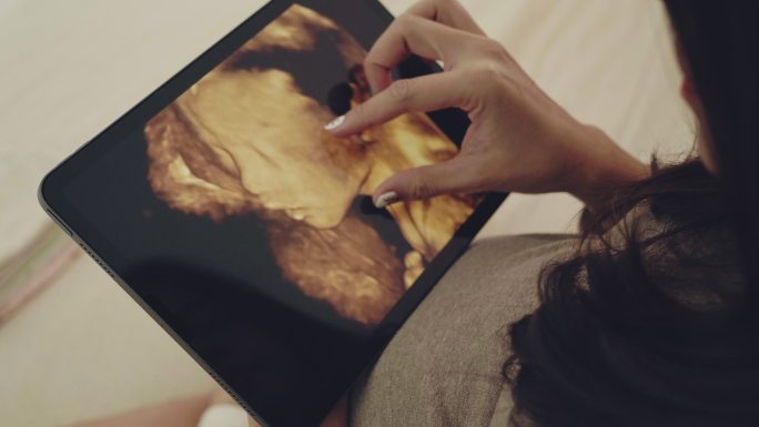 孕妇在数字平板电脑上观看超声图像。