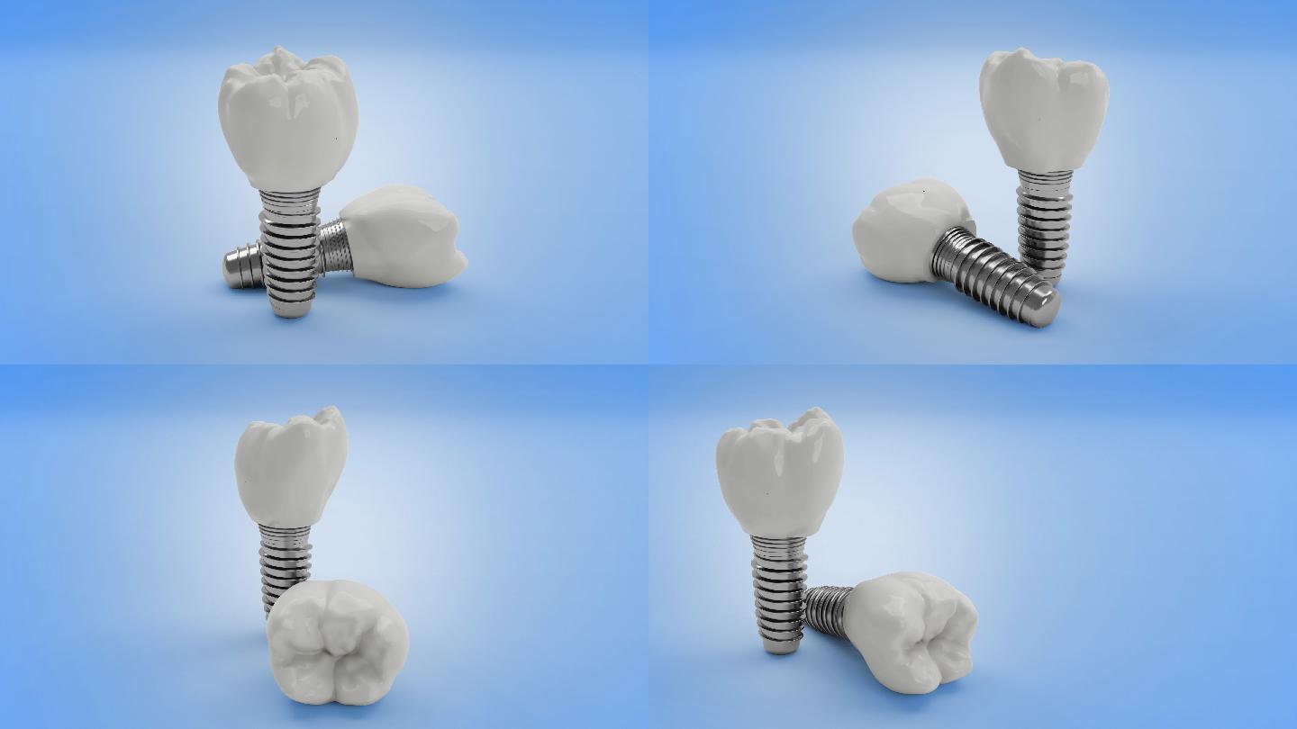 牙科植入物3D特效视频