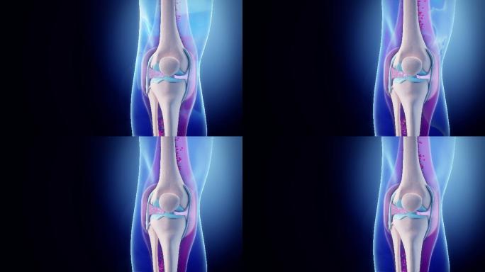 膝关节动画人体组织器官膝盖骨质疏松