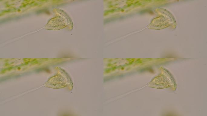 旋涡菌的显微镜观察
