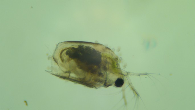 污水中的微生物微观繁殖寄生虫显微镜