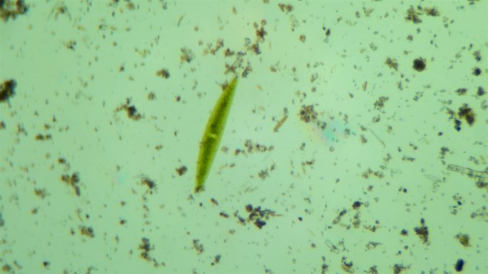 污水中的微生物显微镜草履虫菌落种群