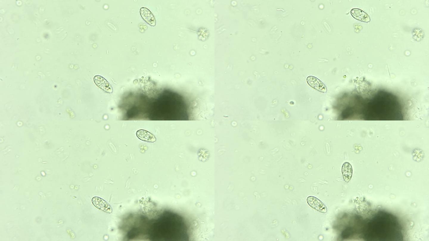 微生物纤毛虫细菌单细胞原生生物 2