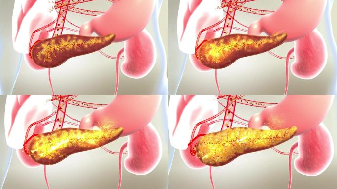 恢复胰腺器官功能正常