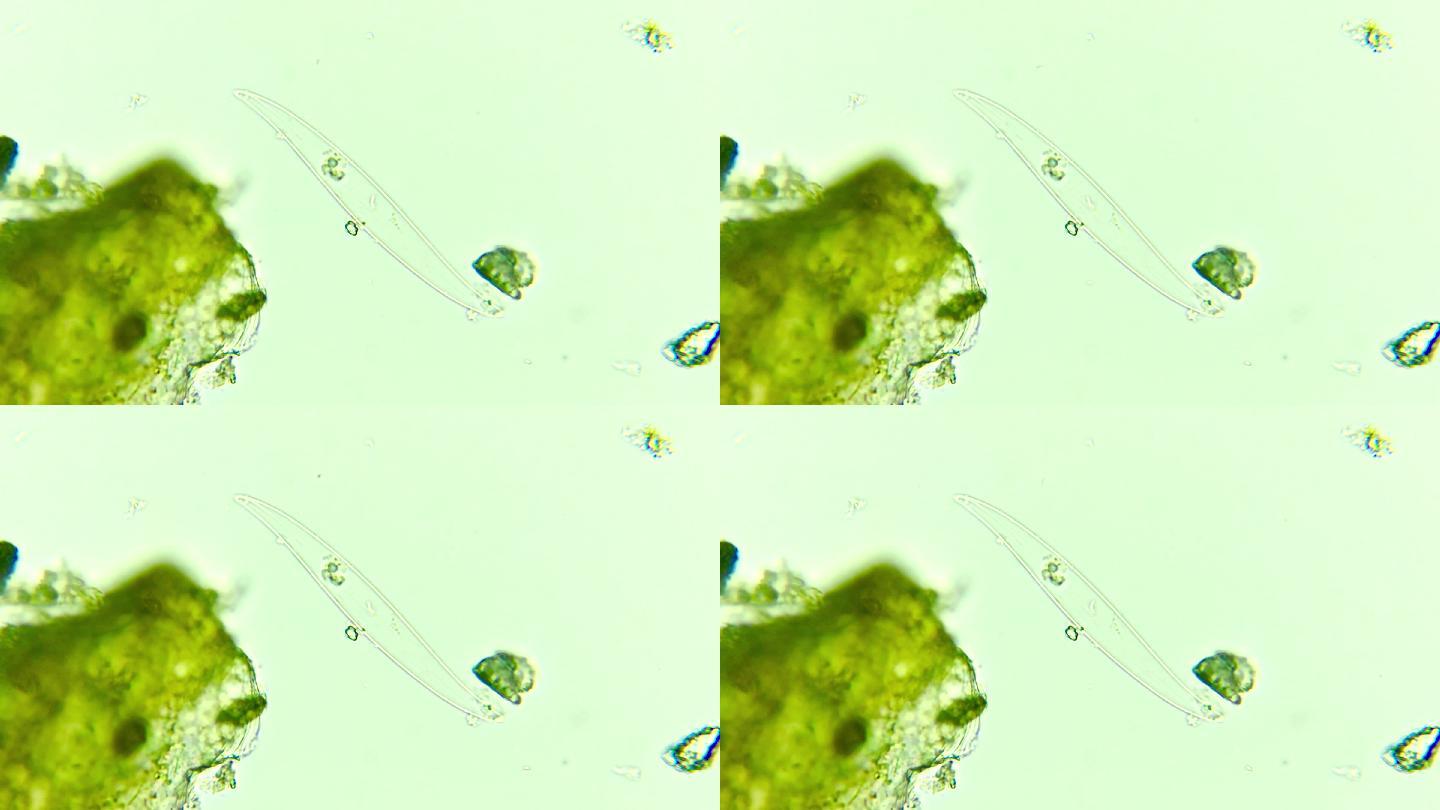 显微镜下的硅藻外壳