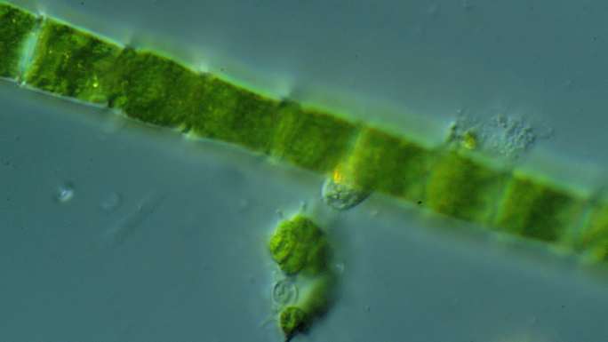 纤毛虫的显微镜观察