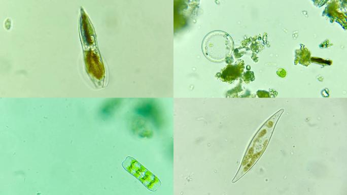 显微摄影 微生物硅藻合集