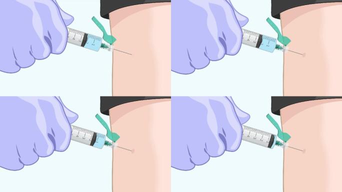 卡通二维MG动画针打 打疫苗