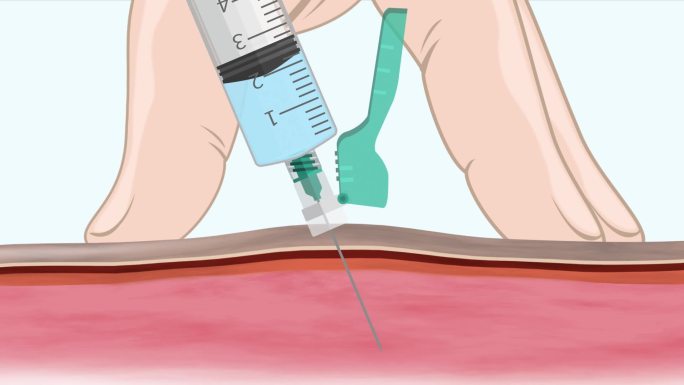 打针卡通 二维 MG动画打疫苗打手臂血管