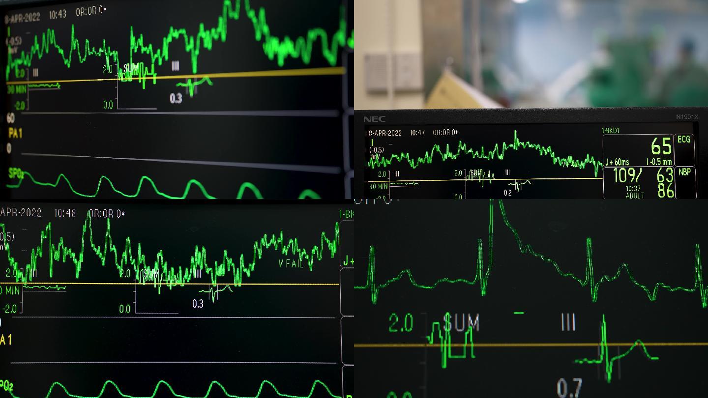 4K手术室抢救室心电监护仪空镜