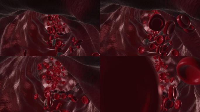 流经静脉的红细胞药效药理治疗