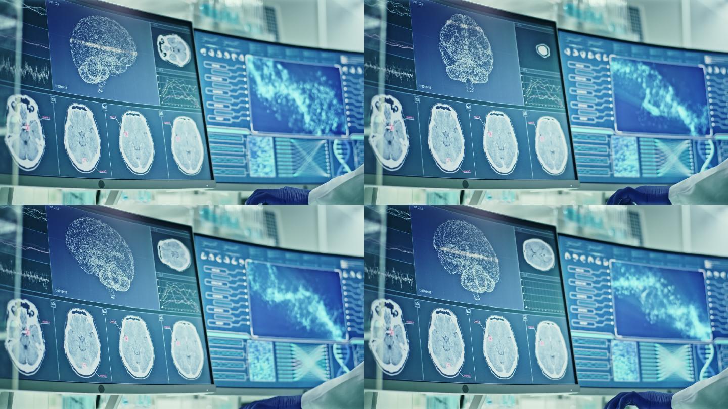 实验室设备、显微镜和计算机。屏幕上的脑电波研究。科学家的后视图