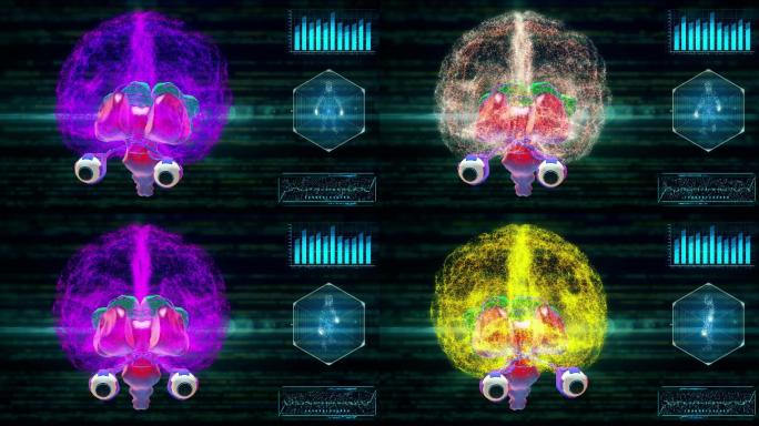 人脑扫描视觉系统特效视频图像展示模板