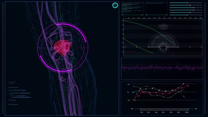 未来派的实验室内部。屏幕上有人体模型。扫描虚拟患者的肘关节损伤。闭合