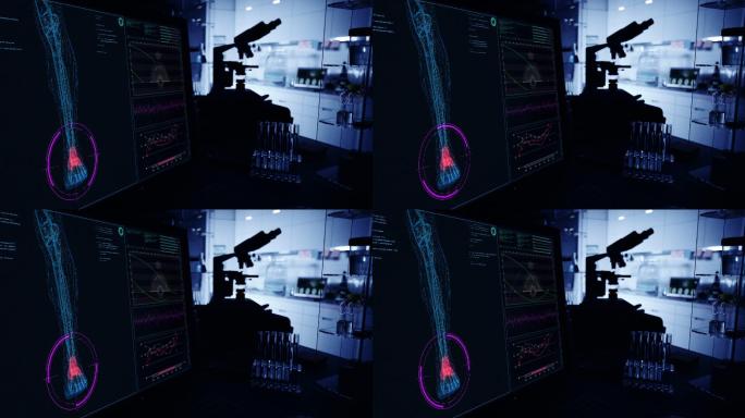 现代实验室。带有动画人体模型的屏幕。扫描虚拟病人的受伤情况。有红色斑纹的脚骨
