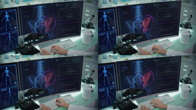 有计算机和显微镜的实验室。带有动画人体模型的屏幕。科学家扫描虚拟病人的受伤情况。臀部有红色斑纹。靠近