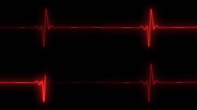 心跳监护 心率 心律 波谱 波纹 波普线