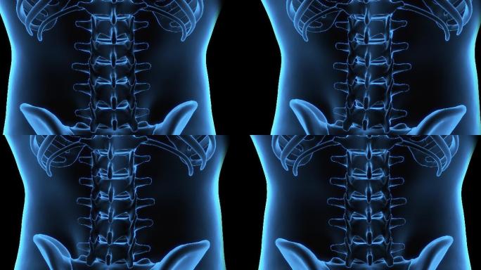 腰椎的3D断层扫描和腰椎的X光片