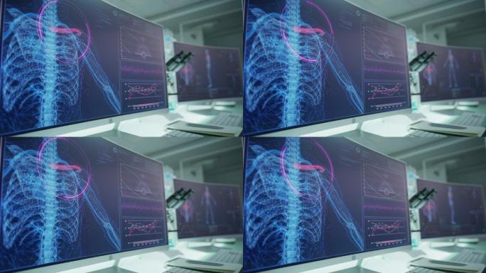 空荡荡的实验室里有电脑和显微镜。带有动画人体模型的屏幕。扫描虚拟病人的受伤情况。肩上有红色标记