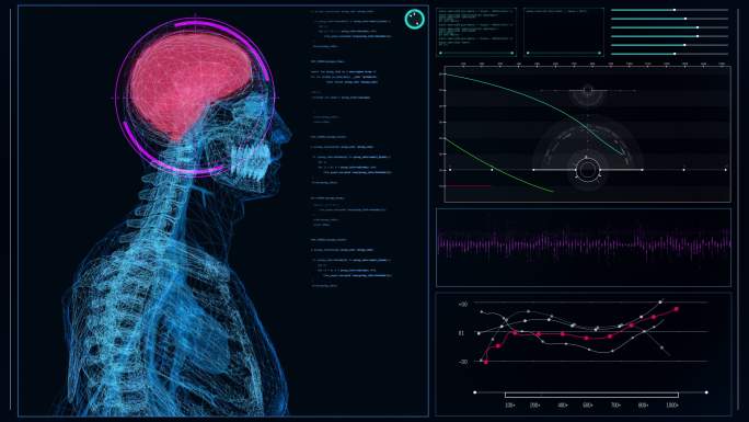 未来派的实验室内部。屏幕上有人体模型。扫描虚拟患者的大脑内部损伤
