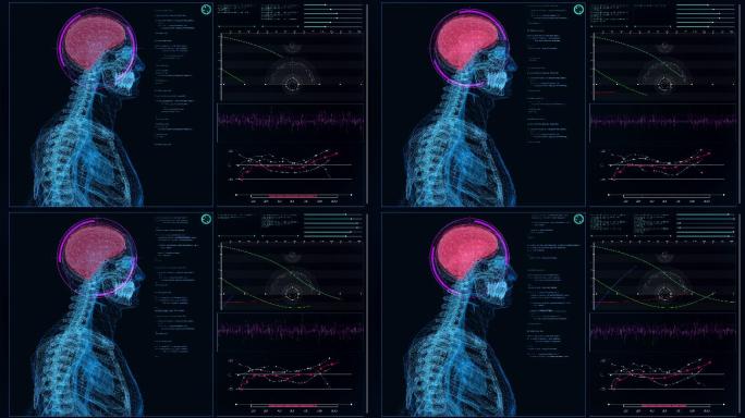 未来派的实验室内部。屏幕上有人体模型。扫描虚拟患者的大脑内部损伤
