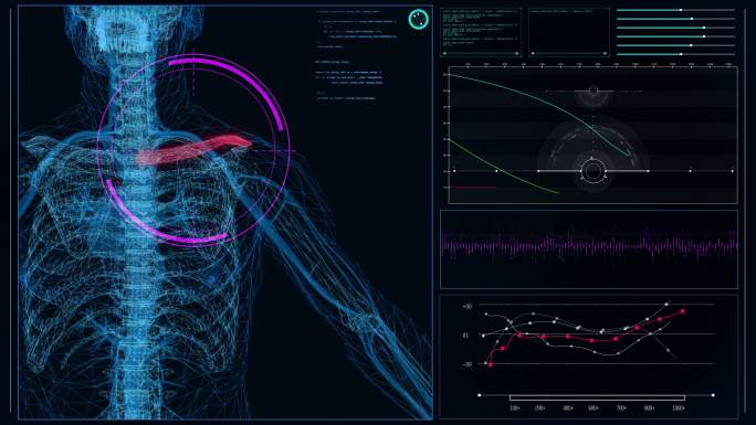 未来派的实验室内部。屏幕上有人体模型。扫描虚拟患者的肩部损伤。闭合
