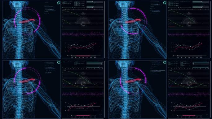 未来派的实验室内部。屏幕上有人体模型。扫描虚拟患者的肩部损伤。闭合