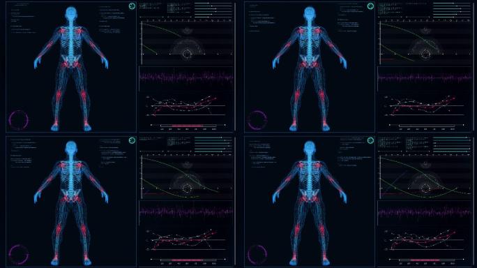 未来派的实验室内部。屏幕上有人体模型。扫描虚拟患者的关节损伤