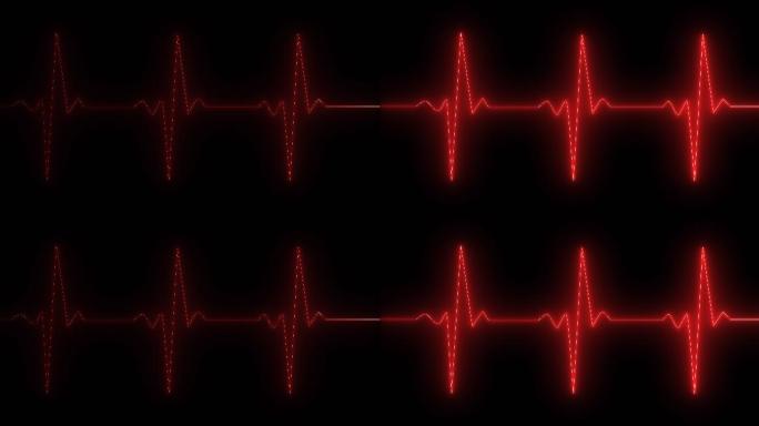 心电图 心脏 跳动心率 心律 波谱 波纹