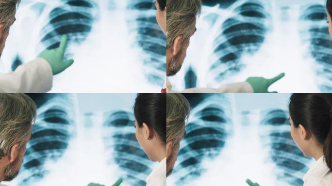 科学家正在观察感染了冠状病毒delta变种的人类肺部X光片。闭合。