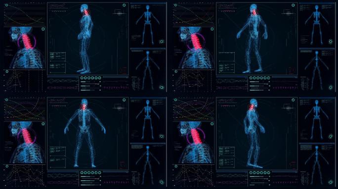 未来实验室。带有动画人体模型的屏幕。扫描虚拟病人的受伤情况。脖子上有红点