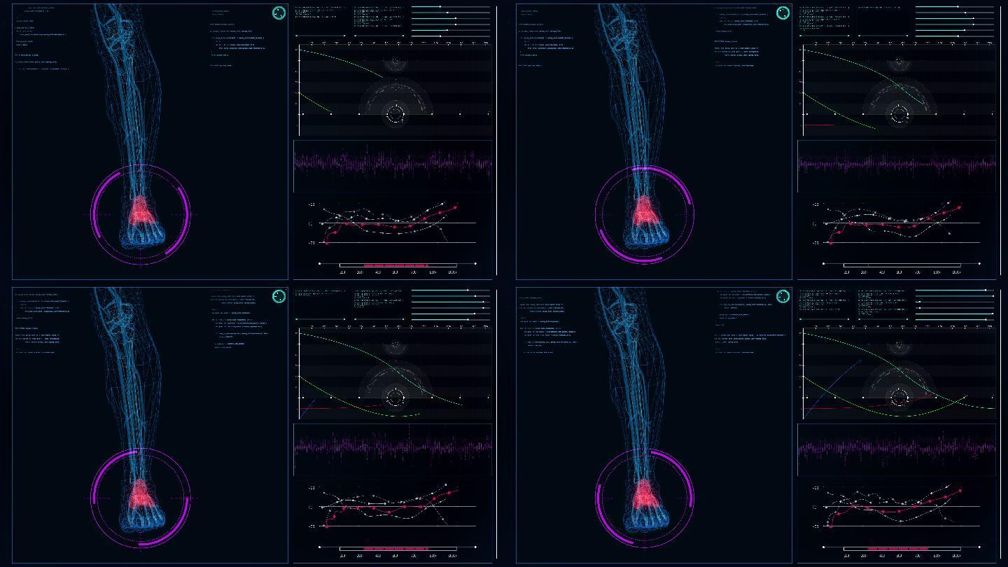 未来派的实验室内部。屏幕上有人体模型。扫描虚拟患者的足部损伤