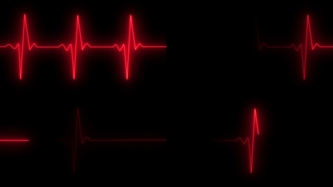 4款心电图（视频包）心脏 跳动心跳监护