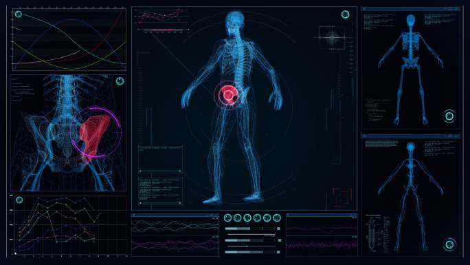 未来实验室。带有动画人体模型的屏幕。扫描虚拟病人的受伤情况。臀部有红色斑纹