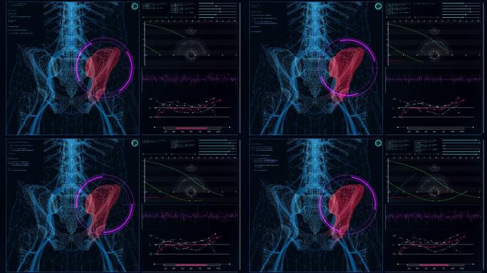 未来实验室。带有动画人体模型的屏幕。扫描虚拟病人的受伤情况。臀部有红色斑纹。闭合