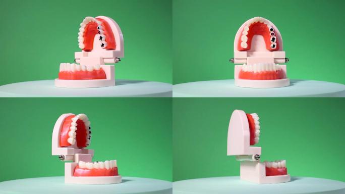 绿幕蛀牙 牙齿假牙旋转 大牙蛀齿